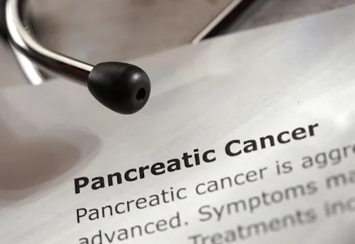 pancreatic cancer